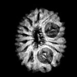 13 Mukhi Indonesian Rudraksha (16.00 Mm) X-Ray