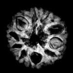 10 Mukhi Indonesian Rudraksha (15.65 Mm) X-Ray