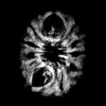 11 Mukhi Rudraksha 16.05 Mm X-Ray