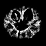 11 Mukhi Rudraksha 16.10 Mm X-Ray
