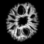 11 Mukhi Rudraksha 19.73 Mm X-Ray