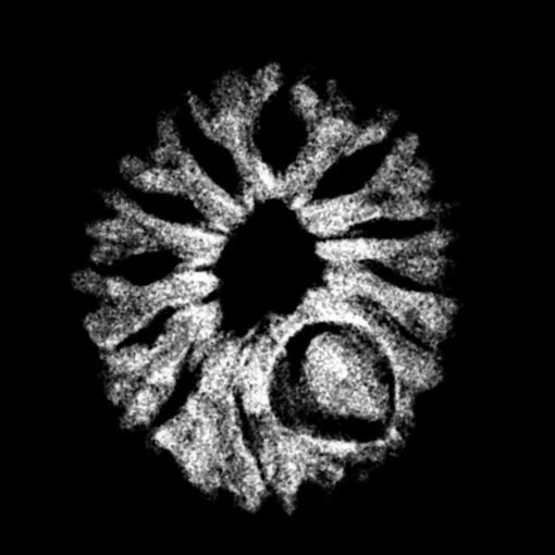 12 mukhi rudraksha 18.18 mm x-ray