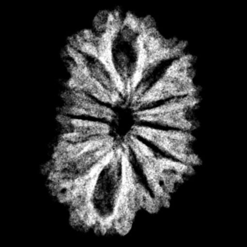 12 mukhi rudraksha 18.80 mm x-ray