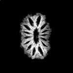 14-Mukhi-Indonesian-Rudraksha-15.75-Mm-With-X-Ray-1.Jpg