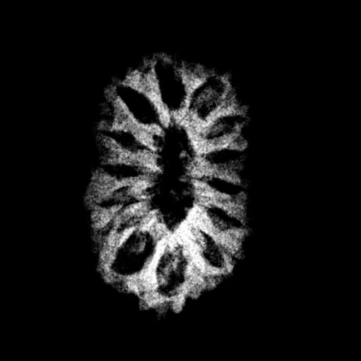 Fourteen-Mukhi-Indonesian-Rudraksha-17.30-MM-With-X-Ray-1.jpg