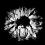 9 Mukhi Rudraksha 23.15 Mm X-Ray