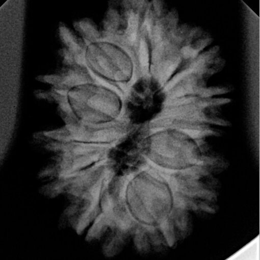 12-Mukhi-Nepal-Rudraksha-25.58-MM-X-Ray-C.jpg