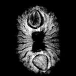 16 Mukhi Rudraksha Indonesian ( 18.02 Mm ) X-Ray