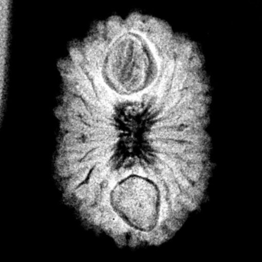 16-mukhi-rudraksha-Indonesian-18.28-mm-X-Ray.jpg October 18, 2024 127 KB