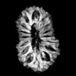 16 Mukhi Rudraksha Indonesian ( 18.80 Mm ) X-Ray