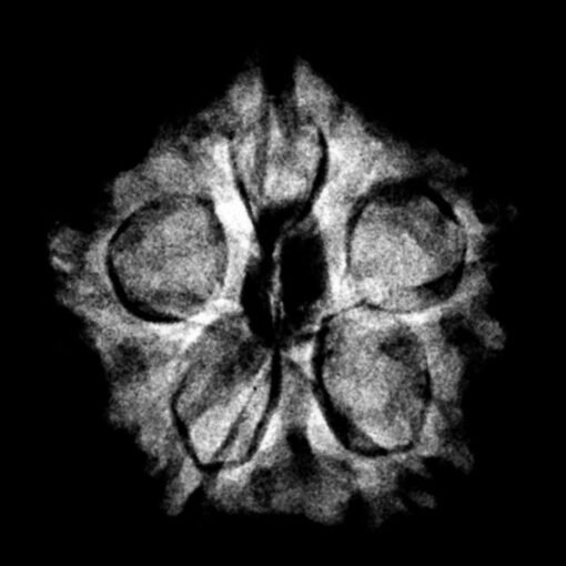 5 mukhi rudraksha 18.94 mm x-ray