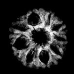 9 Mukhi Rudraksha 17.90 Mm X-Ray