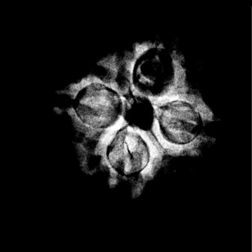 Four Face Rudraksha Nepal - (18.50 MM ) X-Ray