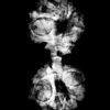 Gaurishankar Rudraksha (30.05 Mm) X-Ray
