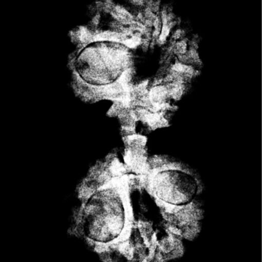Gaurishankar Rudraksha (30.05 Mm) X-Ray
