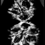 Rudraksha-Nepal32.55-Mm X-Ray