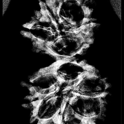 Rudraksha-Nepal32.55-Mm X-Ray