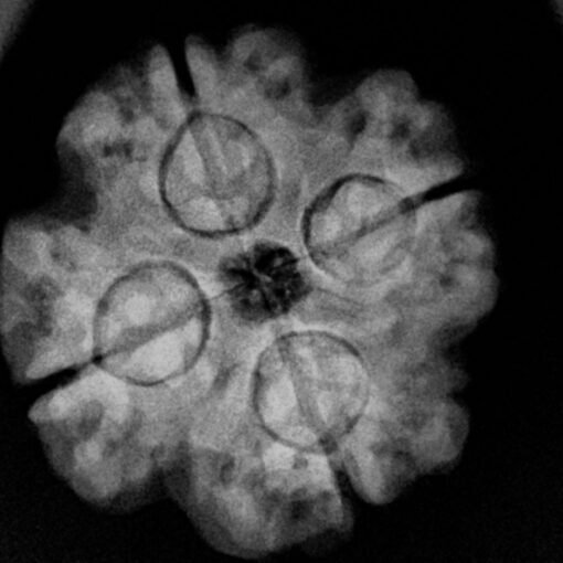 4-Mukhi-Nepal-Rudraksha-16.70-MM-X-Ray.jpg January 21, 2025 116 KB 1100 by 1100 pixels