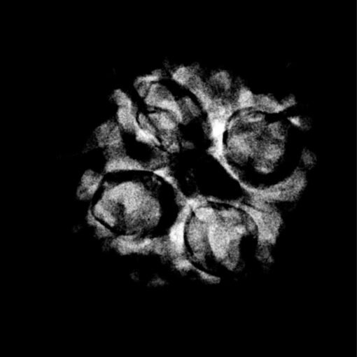 4 Mukhi Rudraksha Nepal - (20.69 MM ) X-Ray