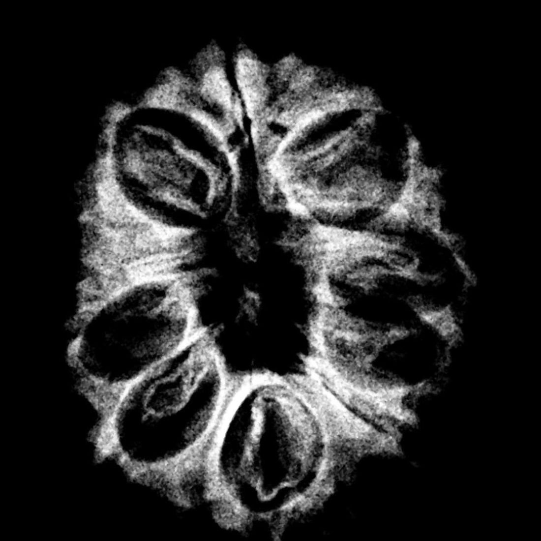 14 Mukhi Rudraksha Nepal - 23.45 Mm - (Rudrapuja) 6 14 Mukhi Rudraksha Nepal - 23.45 Mm