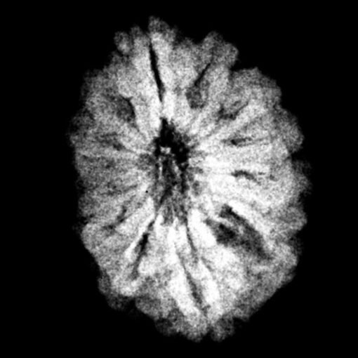 12 mukhi rudraksha 18.75 mm x-ray