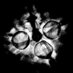 4 Mukhi Rudraksha 18.60 Mm X-Ray (2)