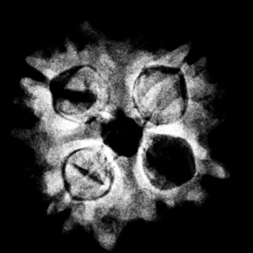 4 Mukhi Rudraksha 19.50 Mm X-Ray