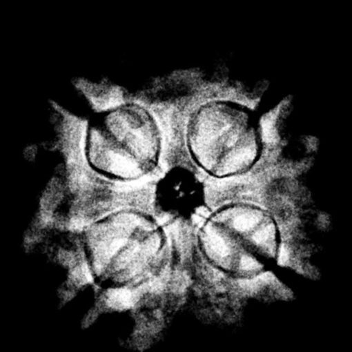 4 Mukhi Rudraksha 20.00 Mm X-Ray