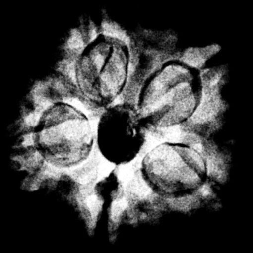 5 Muukhi Rudraksha 19.33 Mm X-Ray