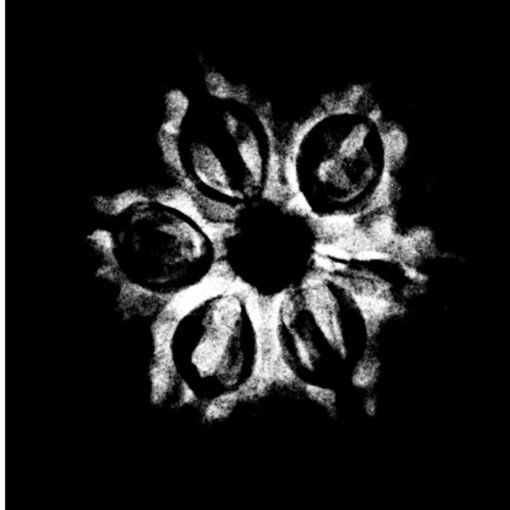 6-Mukhi-Nepal-20.13-Mm-X-Ray.jpg