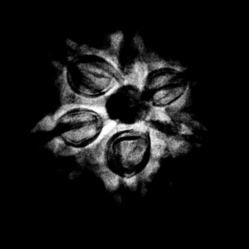 6-Mukhi-Rudraksha-Nepal-19.40Mm-X-Ray.jpg