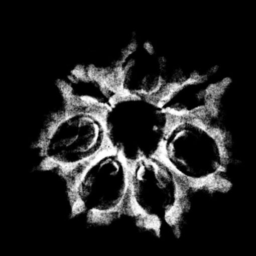 7 Mukhi Nepal Rudraksha ( 21.05 Mm) X-Ray