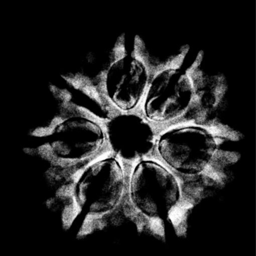 20.33-MM-X-Ray.jpg
