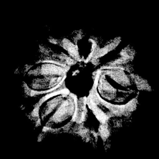 7 Mukhi Nepal Rudraksha (19.40 MM) x-ray