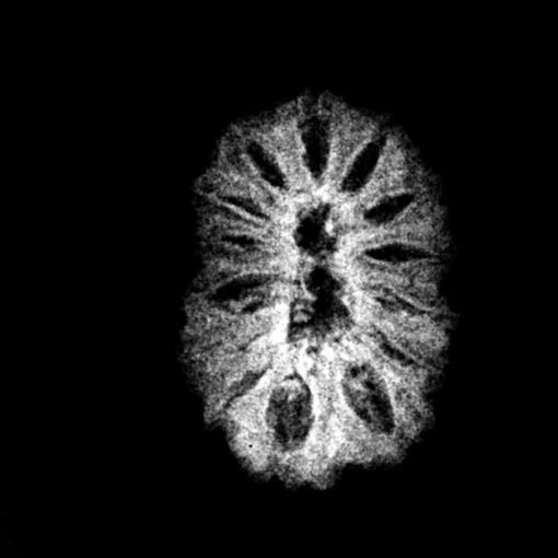 14-Mukhi-Indonesian-Rudraksha-17.55-MM-X-Ray.jpg